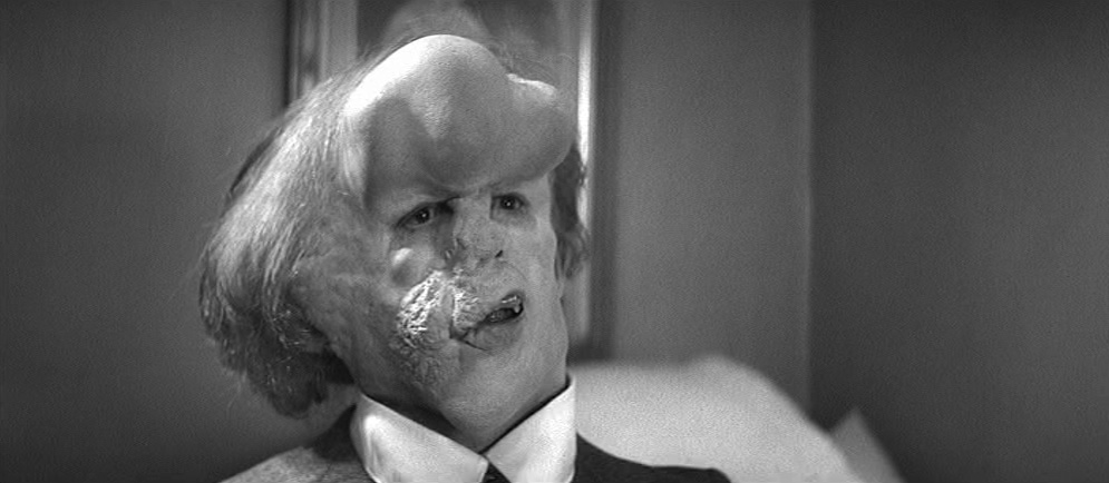 John Hurt as John Merrick in The Elephant Man