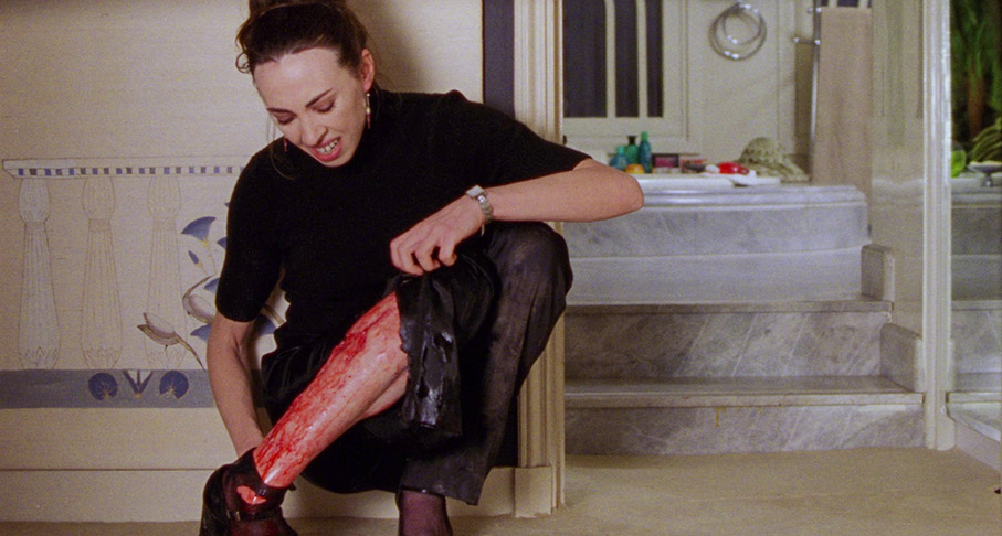 Esther discivers she has injured her leg