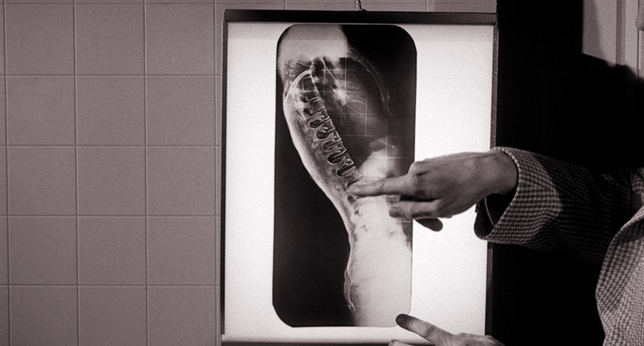 Warren examines an x-ray of the Tingler